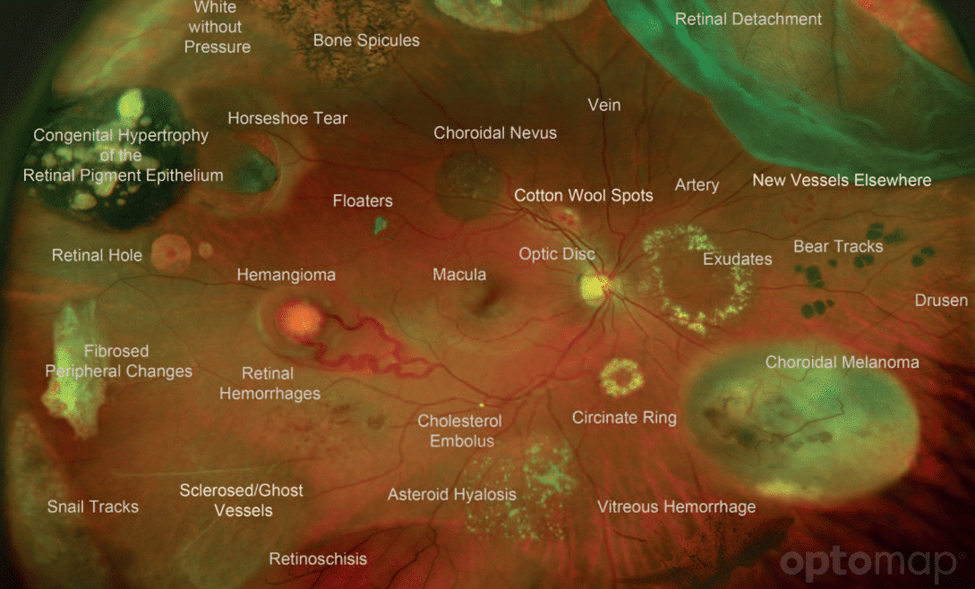 Icare Optical Services iCare Optical