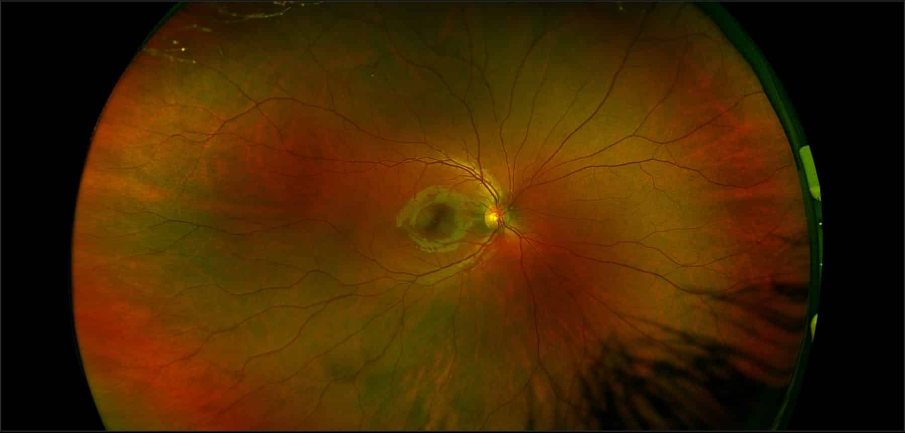 Icare Optical Services iCare Optical